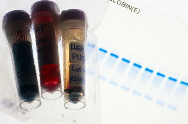Các mẫu thử doping của vận động viên Nga