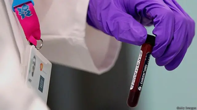 WADA hesabatı təşkilatın özü tərəfindən apardığı araşdırmanın nəticələrinə əsaslanır.