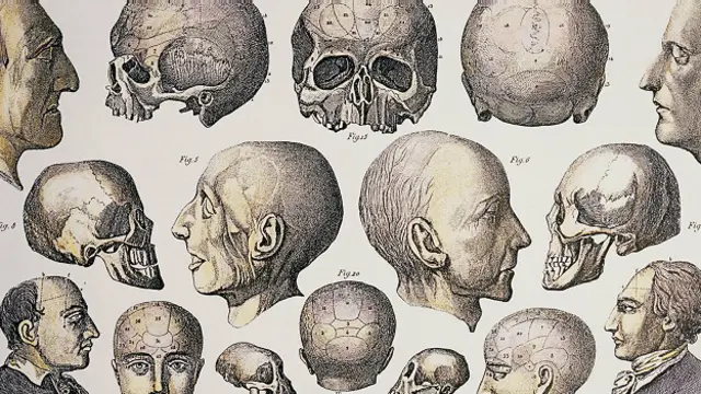 Френология