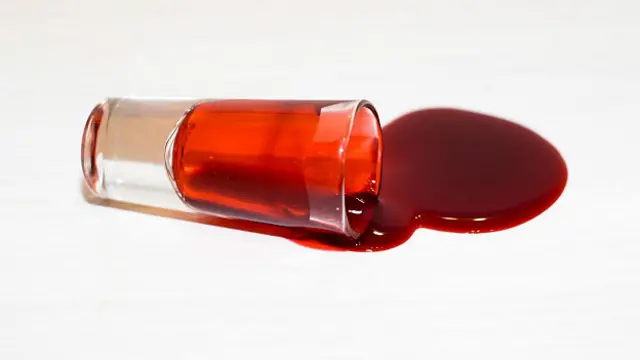 Из-за недоброго отношения со стороны общества вампиры стараются скрывать свое состояние даже от близких