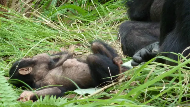 Bebê apresentava hérnia no abdômen e danos da coluna, além de problemas motores