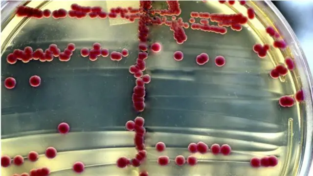 اینٹی بایوٹک سے مدافعت پیدا کرنے والے عوامل کا نام ایم سی آر 1 دیا گیا ہے