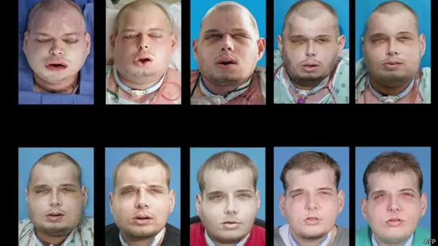 पैट्रिक हार्डिसन