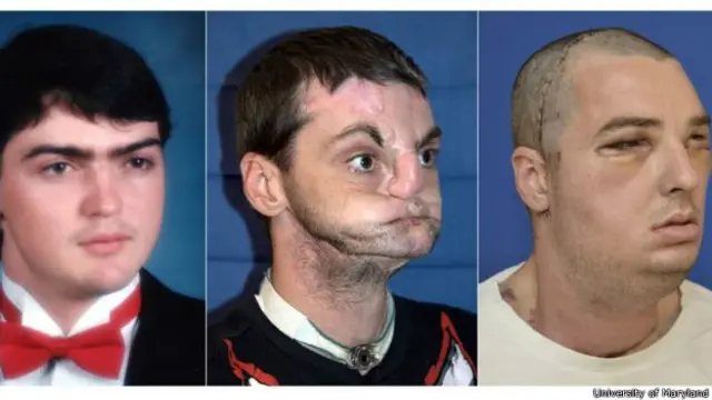 रिचर्ड नोरिस