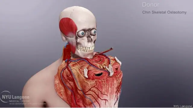 ऊतक और हड्डियां