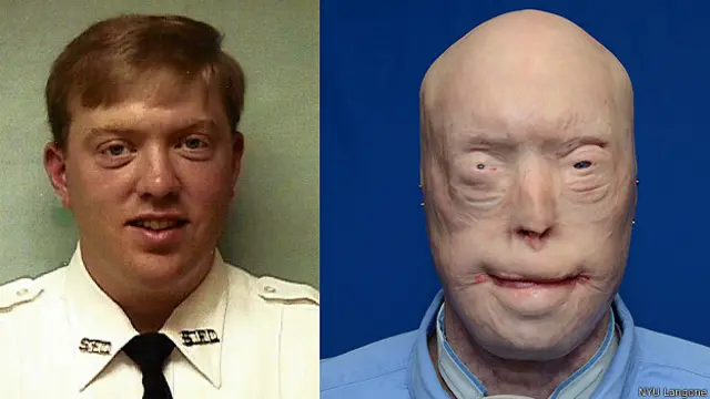 पैट्रिक हार्डिसन