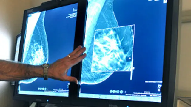 Las imágenes de los experimentos eran en color y también en blanco y negro. 