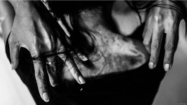 ’شرلی کی کمر پر ان کے مالک کے گھر میں ایک حادثے کے دوران گرم سوپ گر گیا تھا جس کے بعد ان کا معاہدہ اچانک ختم کر دیا گیا تھا۔‘