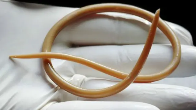 गोलकृमि