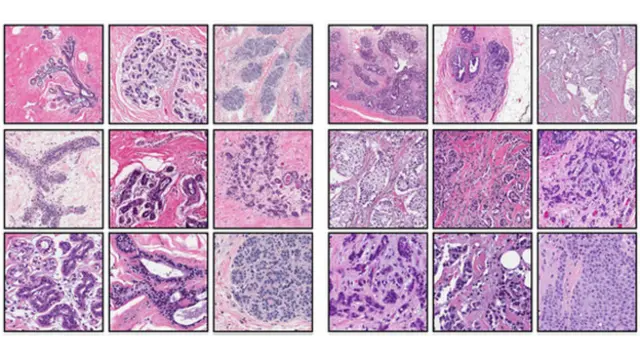 نمونه بافت‌هایی که به کبوترها نشان داده شد (بافت‌های سالم: چپ، بافت‌های سرطانی: راست)