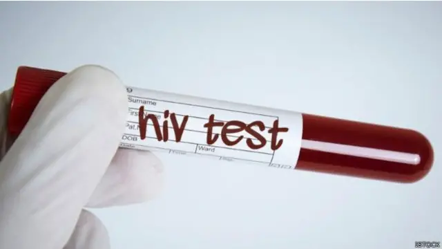 एचआईवी