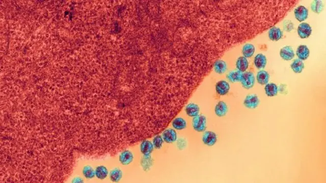 فيروس "إتش آي في" خلال مهاجمته إحدى الخلايا 