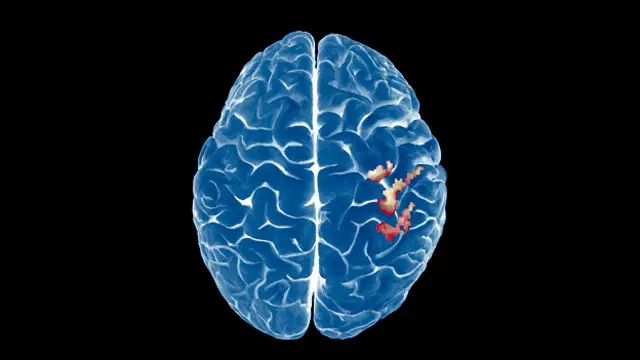 К удивлению ученых, оказалось, что мозг, не занятый конкретными задачами, все равно проявляет активность