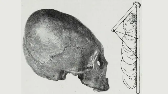 Un diagramada de una cuna para modificar el cráneo de un bebé