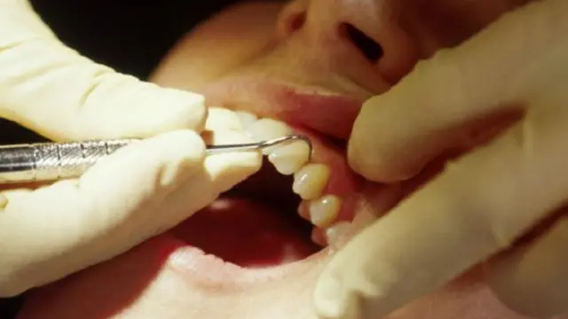 أثبتت الدراسة أن من لديهم مخاوف مرضية من علاج الأسنان يمكن علاجهم بدون تخدير عن طريق علاج بجلسات الحوار