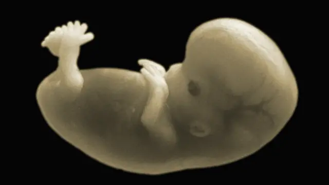 Аборт разрешен в Северной Ирландии лишь в исключительных случаях