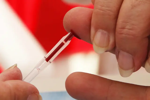 Пресса: почему в Украине становится больше ВИЧ-инфицированных