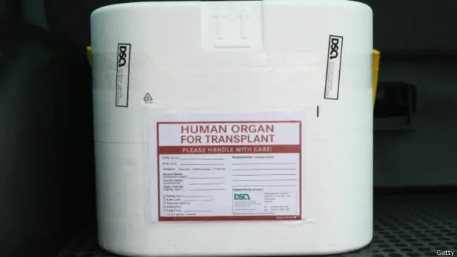 移植器官運輸專用箱。人總有一死。與其死後埋入地下或燒成灰,何不將有用的器官捐獻出來,救人一命?延續生命,他人的,也是自己的。