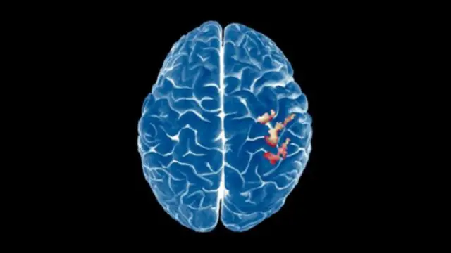 ما أثار دهشة العلماء هو اكتشاف نشاط للدماغ حينما كان المتطوعون في حالة راحة واسترخاء تام