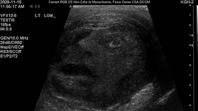 Лицо, заключенное в мошонке