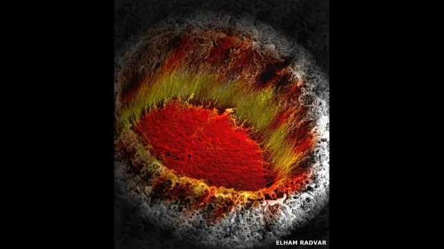 Elham Radvarın şəklində biopolimer və peptidlərin formalaşması nəticəsində membran pərdəsi üzərində əmələ gələn lifsayağı şəbəkəni nümayiş etdirir. Elektron mikroskopu ilə çəkilmiş təsviri vulkan kraterinə bənzətmək üçün şəkil rəngləndirilib. 