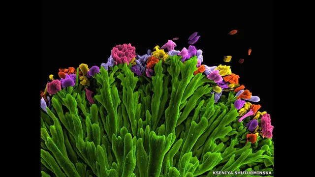 Queen Mary Universitetində Biomühəndislik İnstitunun təsis edilməsi münasibətilə keçirilən fotomüsabiqəyə İnstitut işçiləri və tələbələr elmi şəkillərini təqdim ediblər. Kseniya Shuturminskayanın elektron mikroskopu vasitəsilə çəkilmiş fotosunda zülal mühitində apatitsayağı mineralların əmələ gəlməsi göstərilir. Mükafata layiq görülmüş iş Buket adlanır. Müvafiq elmi araşdırma kariesin müalicəsilə bağlı dişlərin formalaşması prosesini tədqiq edir. 