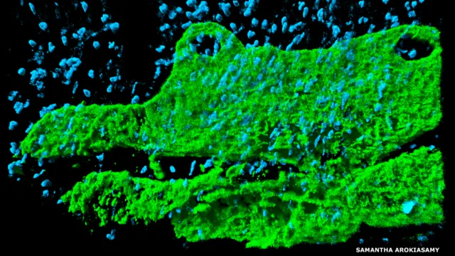 İltihaba məruz qalan toxumada ağ qan hüceyrələri (göy rəngdə) əhatəsində limfatik vəzləri (yaşıl rəngdə) təsvir edən 3 ölçülü şəkil konfokal mikroskop vasitəsilə çəkilib. “Yağışda kərtənkələ” şəkilinin müəllifi Samantha Arokiasamy-dir.
