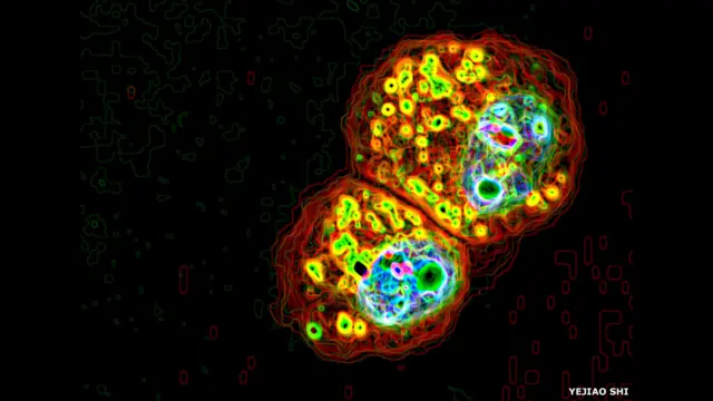 Ribonuklein turşusunun mikrohissəcikləri (yaşıl) xərçəng törəməsi ilə bağlı makrofaq hüceyrələri əhatəsində. Şəklin müəllifi Yejiao Shi-dir.