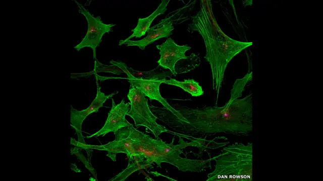 Dan Rowson aktin (yaşıl) və tubulin zülalı (qırmızı) və basal hüceyrələrindən (qırmızı) ibarət insan aenositlərin təsvirini yaradıb. 
