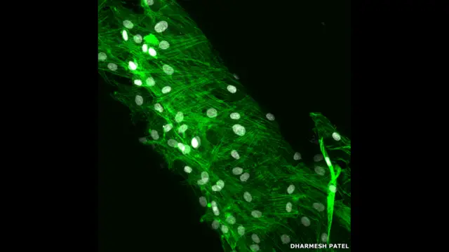 Dharmesh Patel bovin tenositləri yeridilmiş lif toxumasının şəkilini təqdim edib. 