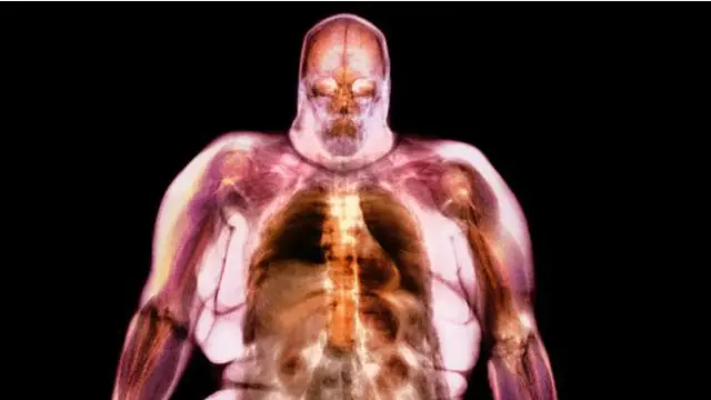 Las minúsculas partículas contaminantes pueden irritar los pulmones y desatar una cascada de reacciones, afectando la capacidad del organismo para manejar lo que comemos.