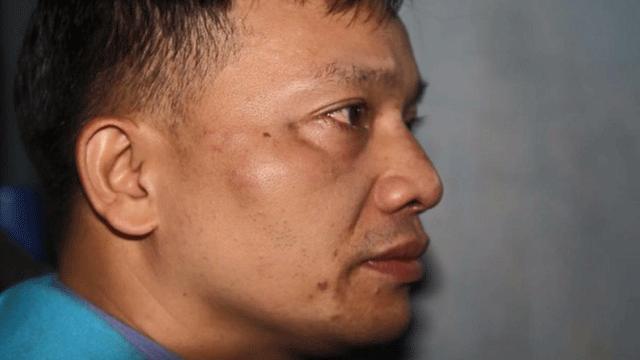 Các tổ chức quốc tế trong đó có LHQ, Phóng viên Không biên giới, HRW nói luật sư nhân quyền Nguyễn Văn Đài bị hàng chục côn đồ hành hung gần đây.