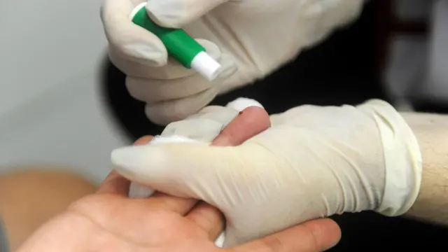 ஹெச்ஐவி சோதனை 