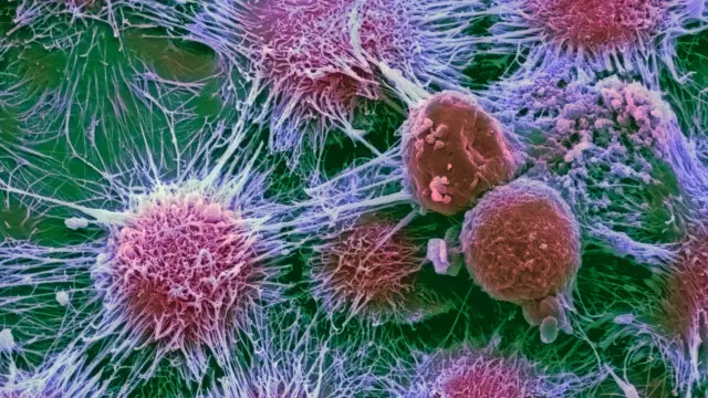 Ракові клітини