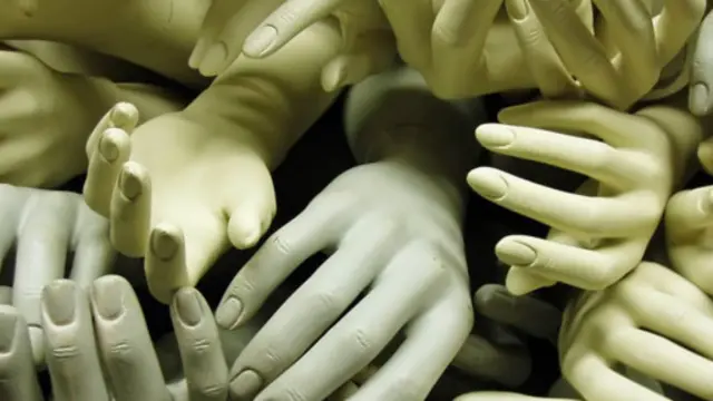 成堆的假肢(图片来源:Thinkstock)