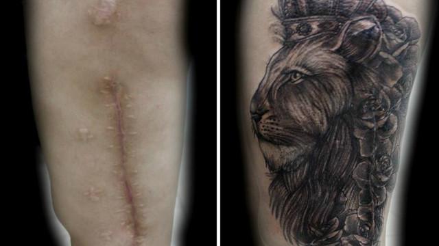 Tatuadora diz que cicatrizes fazem mulheres lembrar da agressão, mas tatuagem permitem resgate da autoestima