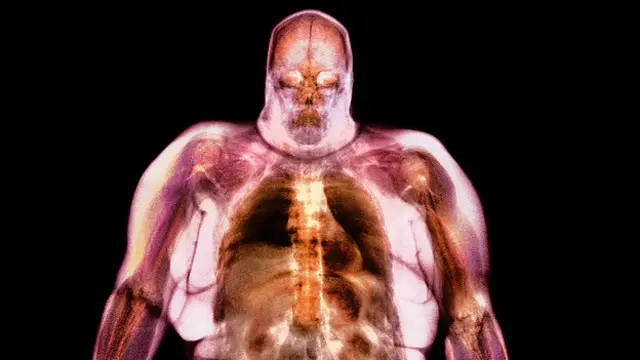 Попав в легкие, крохотные частицы-раздражители могут запустить в организме цепную реакцию, подавляя контролирующие аппетит гормоны