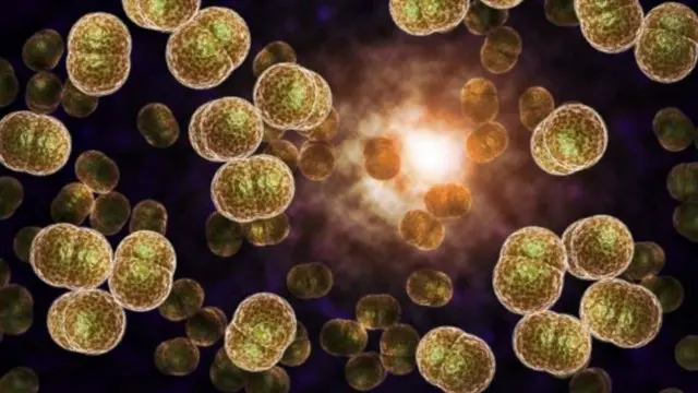 السيلان في مرحلة الخطر ليتحول إلى مرض غير قابل للعلاج نظرا لتطور مقاومته للمضادات.