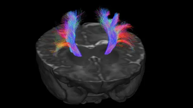 Эта информационная магистраль, соединяющая кору головного мозга со спинным мозгом, позволяет нам контролировать движения и чувствовать прикосновения