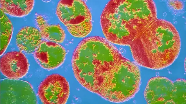 Neisseria gonorrhoeae