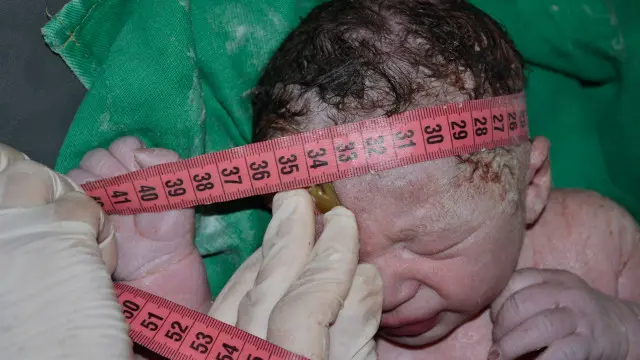 Foto: João Eudesmelhores apostas para hoje bet365Lima