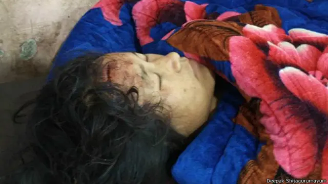 زخمیوں کو ہسپتال میں طبی امداد دی جا رہی ہے