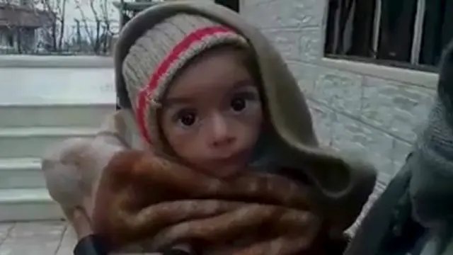 Niño en Madaya