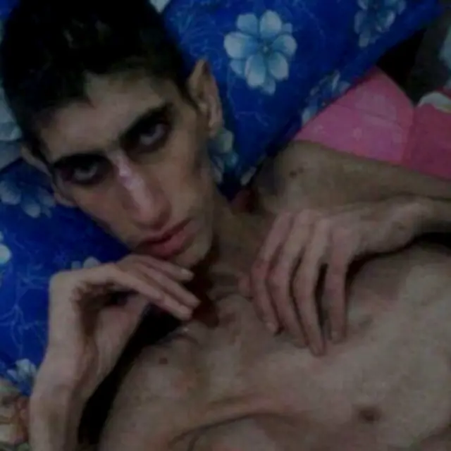 လူတွေသေလုမြောပါးအငတ်ဘေးကြုံနေရ