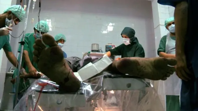 آپریشن روم میں موجود خون اور جراثیم کش دوا کی بدبو قے آور تھی