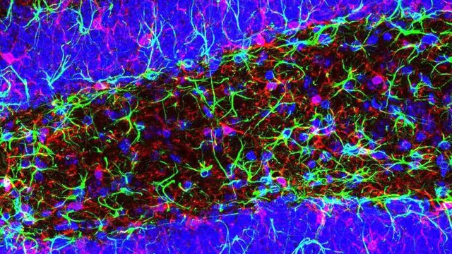 يأمل الباحثون في أن تساعد هذه النتائج في إنتاج عقار جديد لعلاج الزهايمر لدى البشر