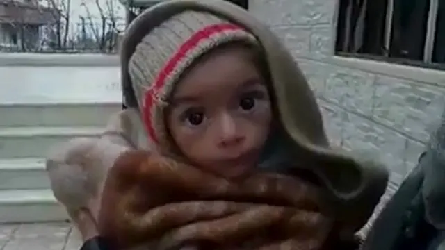 Penduduk kota Madaya mendapat perhatian internasional karena foto-foto warga yang mengalami kelaparan dan kekurangan gizi.