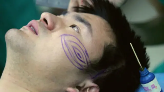 cirugía plásctica en China