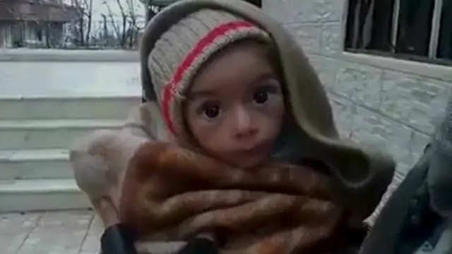 په دې وروستیو کې د دغه ماشوم خوارځواکۍ ځپلې څېرې د ډېرو خواخوږو انسانانو پام ځان ته ور واړوه. 