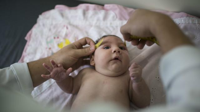 Bebê com microcefalia em Caruaru, Pernambuco | Foto: AP